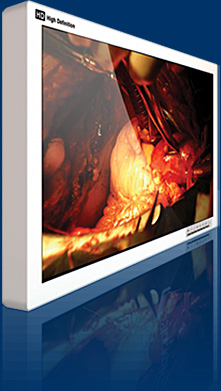 Medical display monitor